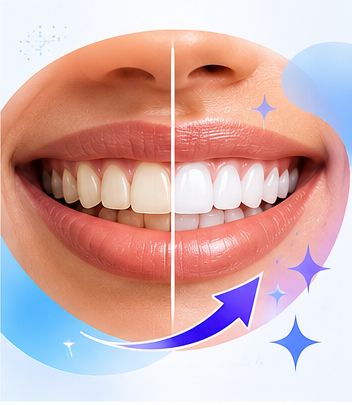 Teeth whitening illustration